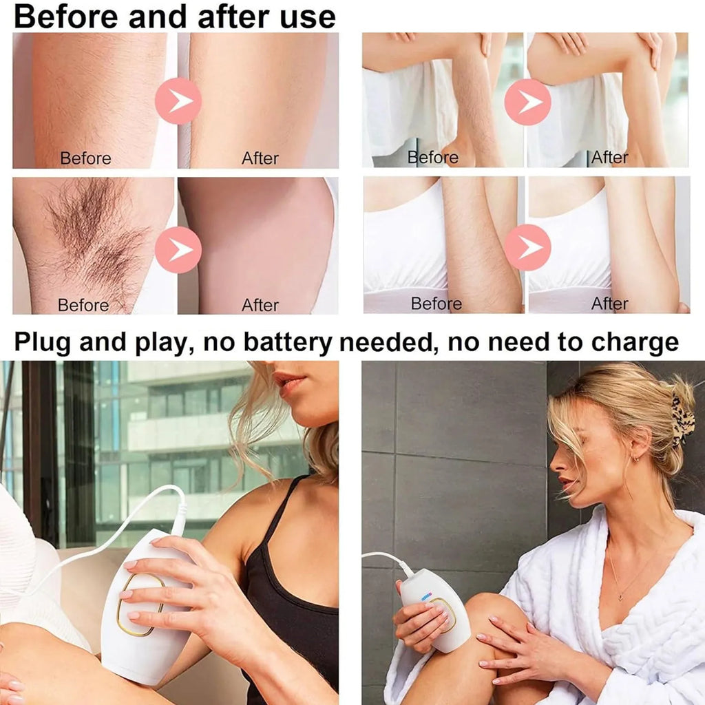 Épilateur IPL Pro, Lisse et doux, 500 000 flashs - Visage, corp et bikini