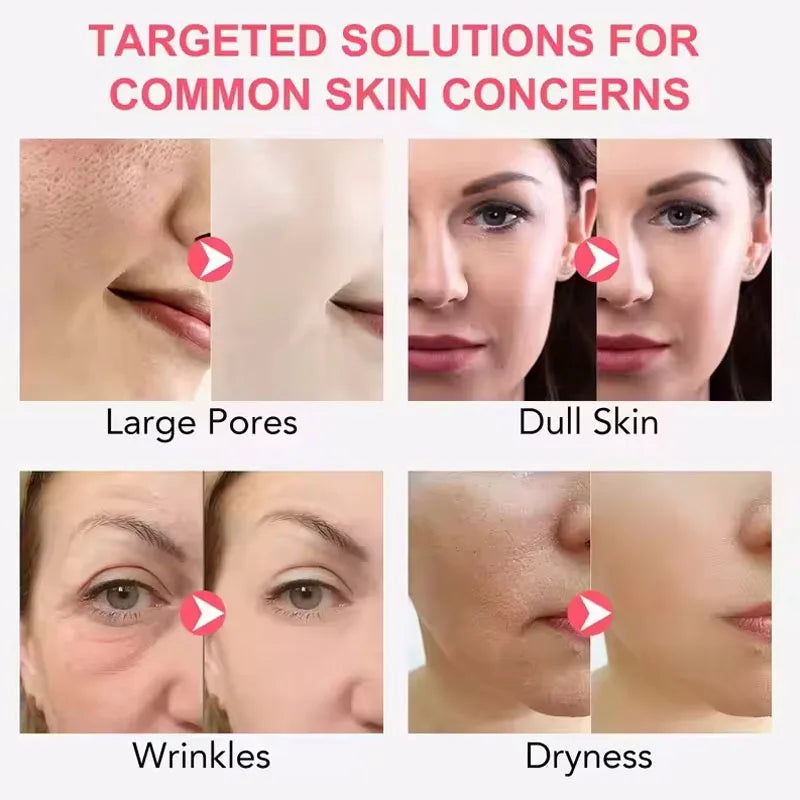 le Moisturizing Face Daily Mask With Niacinamide Hyaluronicacid Korean Cosmet
