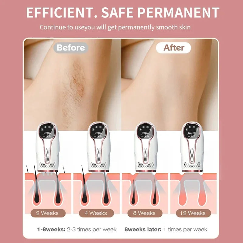 999999 Flashes IPL Laser Epilator for Women Home Use Devices Hair Removal Painless Electric Epilator Bikini Dropshipping